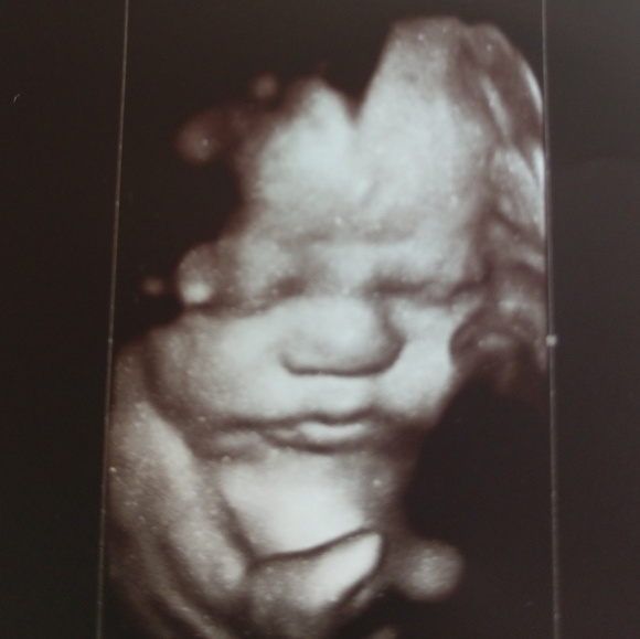 Closet closed - Picture 8 of 8